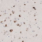 Immunohistochemical staining of human cerebral cortex shows strong granular cytoplasmic positivity in neurons.