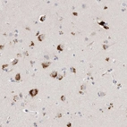 Immunohistochemical staining of human cerebral cortex shows strong granular cytoplasmic positivity in neurons.