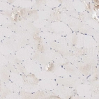 Immunohistochemical staining of human skeletal muscle shows very weak cytoplasmic positivity in myocytes.