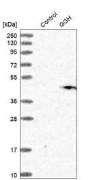 Western blot analysis in control (vector only transfected HEK293T lysate) and GGH over-expression lysate (Co-expressed with a C-terminal myc-DDK tag (~3.1 kDa) in mammalian HEK293T cells, LY418375).