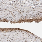 Anti-DFFA Antibody
