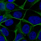 Immunofluorescent staining of MCF7 cells shows localization to plasma membrane.