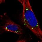 Immunofluorescent staining of human cell line U-251 MG shows localization to vesicles.