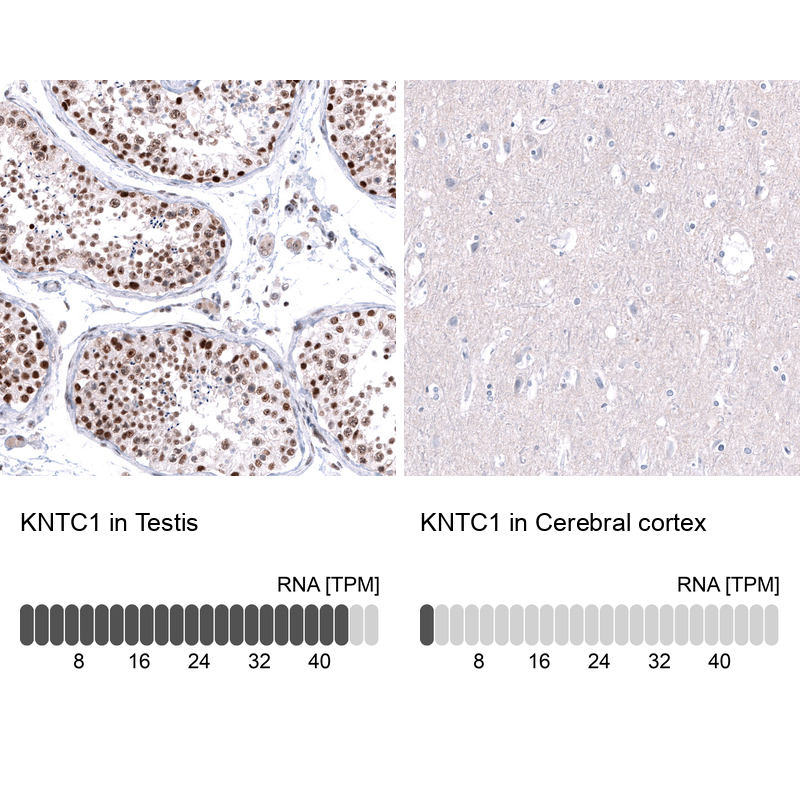 Anti-KNTC1 Antibody