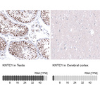Anti-KNTC1 Antibody