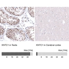 Anti-KNTC1 Antibody