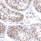 Immunohistochemical staining of human testis shows moderate to strong nuclear positivity in cells in seminiferous ducts.