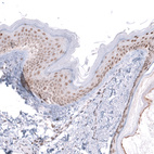 Immunohistochemical staining of human skin shows moderate nuclear positivity in squamous epithelial cells.