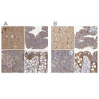 Anti-TSPOAP1 Antibody