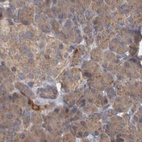 Anti-TSPOAP1 Antibody