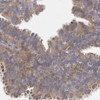 Anti-TSPOAP1 Antibody