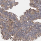 Immunohistochemical staining of human fallopian tube using Anti-TSPOAP1 antibody HPA025244.