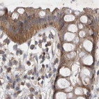 Immunohistochemical staining of human rectum using Anti-TSPOAP1 antibody HPA025244.