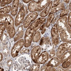 Anti-INSRR Antibody