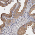 Anti-FBLIM1 Antibody