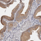 Anti-FBLIM1 Antibody