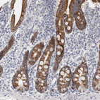 Immunohistochemical staining of human duodenum shows moderate granular cytoplasmic positivity in glandular cells.