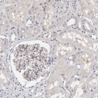 Immunohistochemical staining of human kidney shows weak cytoplasmic positivity in cells in glomeruli.
