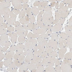 Immunohistochemical staining of human skeletal muscle shows no positivity in myocytes as expected.