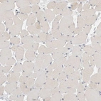Immunohistochemical staining of human skeletal muscle shows no positivity in myocytes as expected.