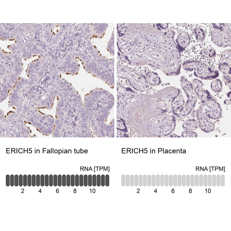 Anti-ERICH5 Antibody