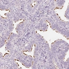 Immunohistochemical staining of human fallopian tube shows high expression.