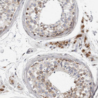 Immunohistochemical staining of human testis shows moderate to strong cytoplasmic positivity in Leydig cells.