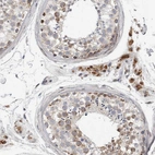 Immunohistochemical staining of human testis shows moderate to strong cytoplasmic positivity in Leydig cells.
