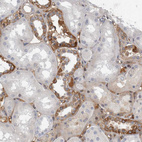 Immunohistochemical staining of human kidney shows moderate to strong cytoplasmic positivity in cells in distal tubules.