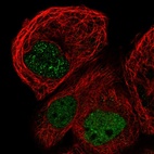 Immunofluorescent staining of human cell line A-431 shows localization to nucleoplasm.