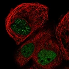 Immunofluorescent staining of human cell line A-431 shows localization to nucleoplasm.