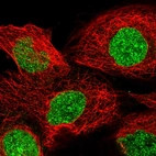 Immunofluorescent staining of human cell line A-431 shows localization to nucleoplasm & nuclear membrane.