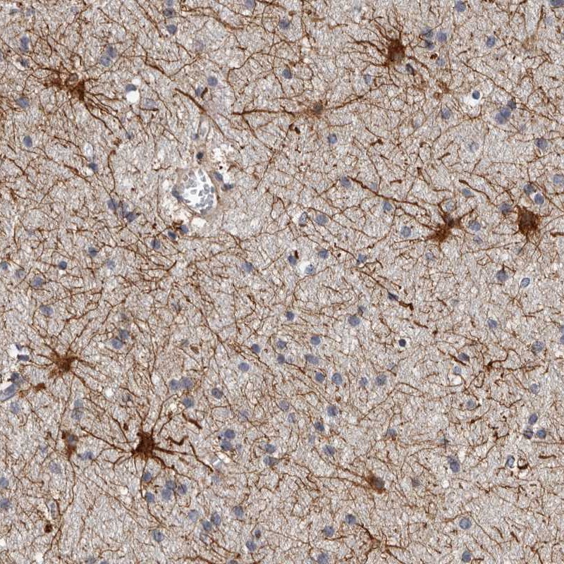 Anti-ADCK5 Antibody