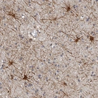 Anti-ADCK5 Antibody