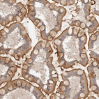 Immunohistochemical staining of human small intestine shows strong membranous positivity in glandular cells.