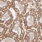 Immunohistochemical staining of human small intestine shows strong membranous positivity in glandular cells.