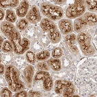 Immunohistochemical staining of human kidney shows strong membranous positivity in cells in tubules.