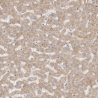 Immunohistochemical staining of human liver shows moderate cytoplasmic positivity in hepatocytes.