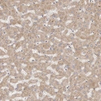 Immunohistochemical staining of human liver shows moderate cytoplasmic positivity in hepatocytes.