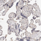 Immunohistochemical staining of human placenta shows no cytoplasmic positivity in trophoblastic cells as expected.