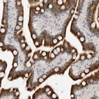 Anti-PCMTD1 Antibody