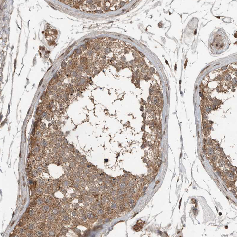 Anti-BLZF1 Antibody