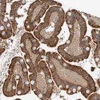 Immunohistochemical staining of human colon shows strong granular cytoplasmic positivity glandular cells.