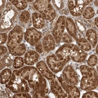 Immunohistochemical staining of human kidney shows strong granular cytoplasmic positivity in cells in tubules.