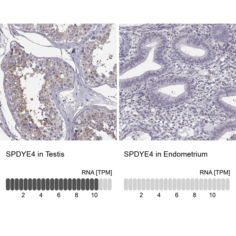 Anti-SPDYE4 Antibody