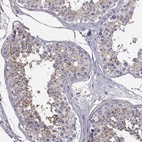 Immunohistochemical staining of human testis shows high expression.