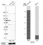 Western blot analysis in human cell line U-251 MG and human cell line MCF-7.