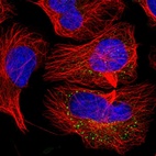 Immunofluorescent staining of human cell line U-2 OS shows localization to vesicles.