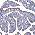 Immunohistochemical staining of human Fallopian tube shows moderate cytoplasmic positivity in glandular cells.