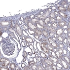 Immunohistochemical staining of human Kidney shows moderate cytoplasmic positivity in cells in tubules.